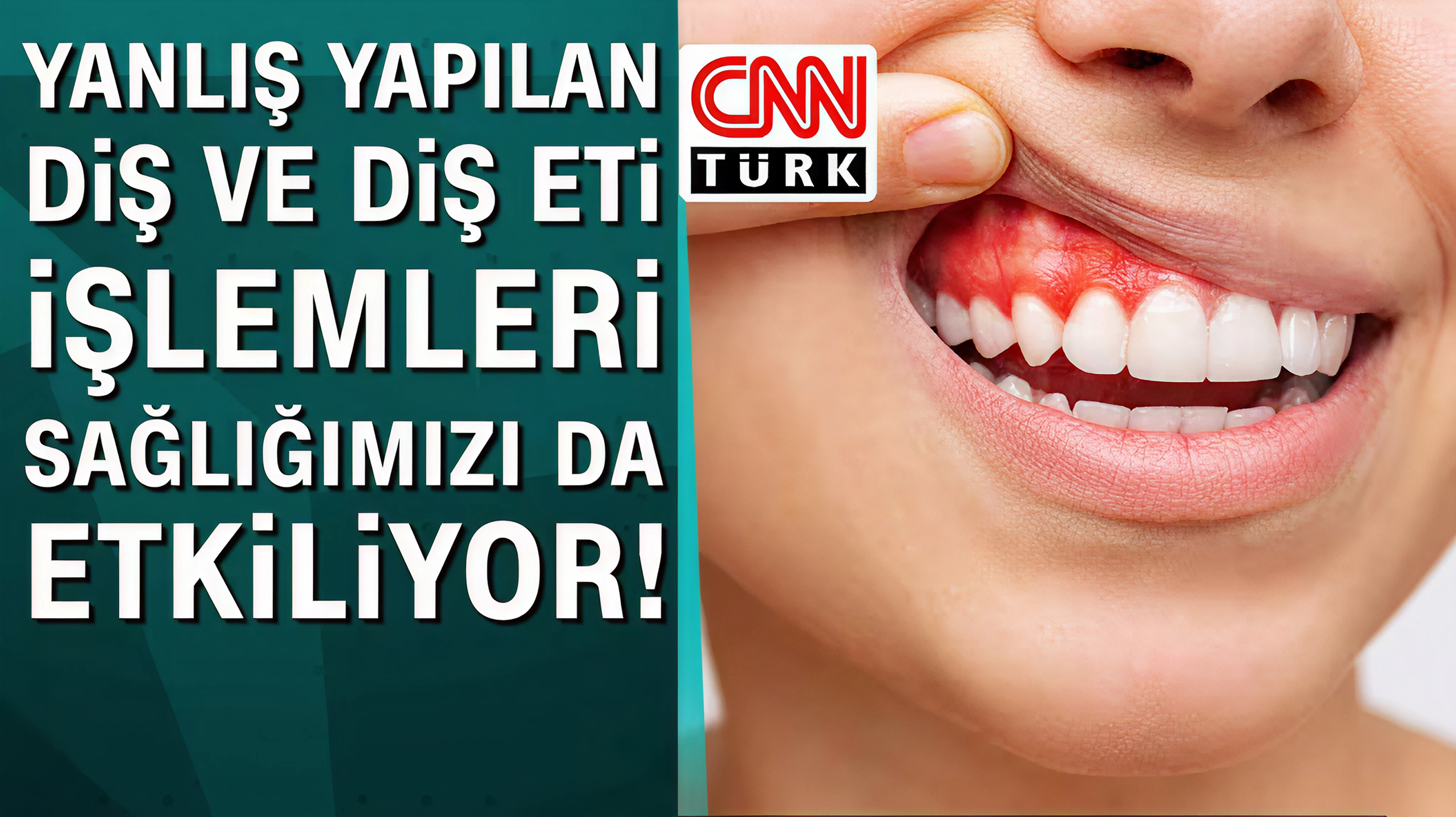 Yanlış yapılan diş ve diş eti işlemleri sağlığımızı da etkiliyor!